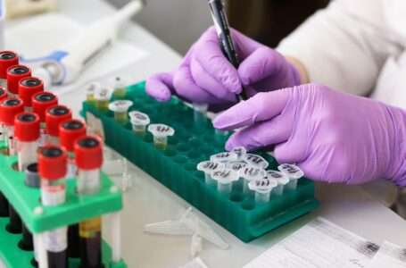 Reguli dupa injectarea cu acid hialuronic in buze