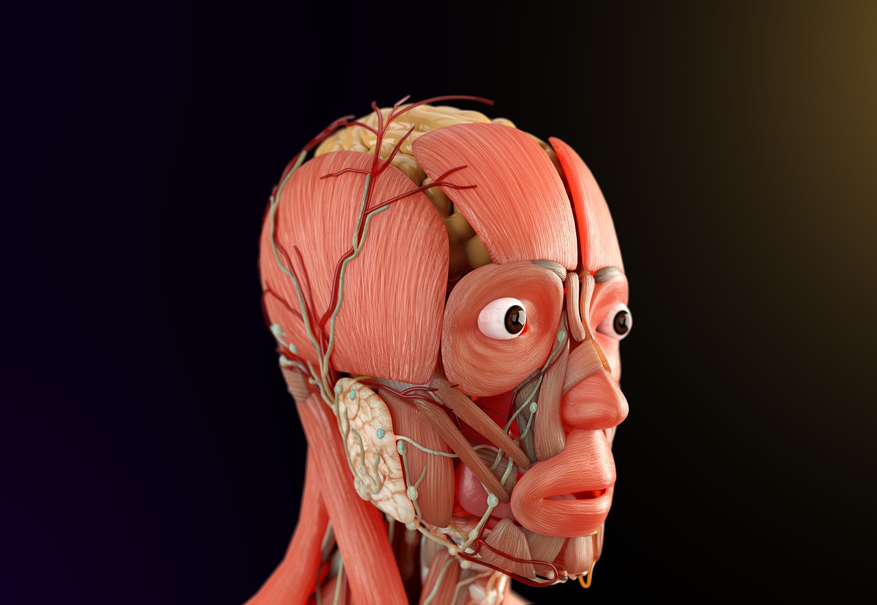 ce inseamna ateromatoza calcificata